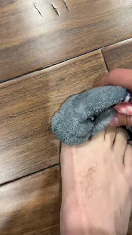 It's gotten SOOOO much better!!!#lunavia #anti #fungal #pen #fyp 