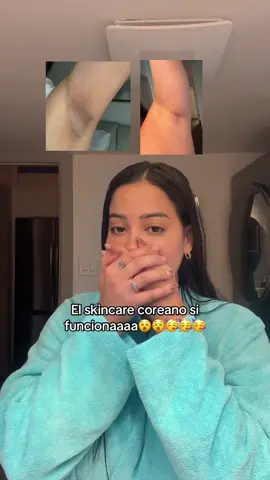 Si me desmanchoooo🥹😭✅ #darkspots #koreanskincare #hyperpigmentation #tiktokshopcybermonday #tiktokshopblackfriday 