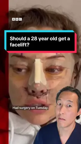 My thoughts on performing a facelift on a 28 year old… video credit: @BBC News #facelift #plasticsurgeon 