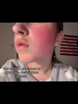 #румяна #краснаякожа #кожа #природа #гены 