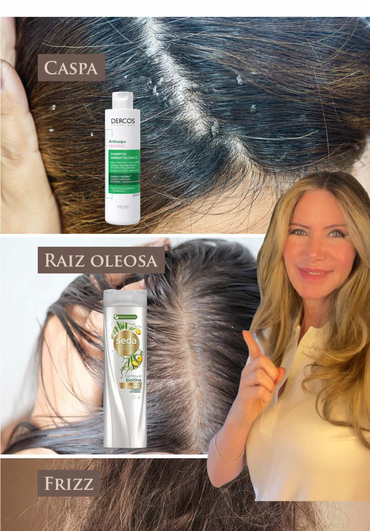 Se você tem...  ⚜️ Caspa – Shampoo Dercos Vichy Anticaspa é formulado com Dissulfeto de Selênio e Ácido Salicílico, ele atua diretamente na causa da caspa, controlando a proliferação do fungo Malassezia e promovendo a renovação do couro cabeludo.  ⚜️ Raiz oleosa – Shampoo Seda Bamboo, o extrato de bambu tem ação purificante e remineralizante, ajudando a equilibrar a oleosidade da raiz sem ressecar o comprimento. É uma boa opção de uso diário para quem sente o cabelo “pesar” rapidamente. ⚜️Frizz – Sérum Capilar Mise En Scène Perfect contém óleos vegetais e silicones leves que criam um filme protetor sobre os fios, reduzindo a eletricidade estática e o arrepiado. Ajuda a alinhar o cabelo, dar brilho e proteger contra o calor do secador e da chapinha. ⚜️ Acne nas costas – Sabonete Granado de Enxofre, o enxofre tem ação secativa, antisséptica e reguladora da oleosidade, o que ajuda a controlar a proliferação bacteriana e reduzir inflamações causadas pela acne corporal. Ideal para áreas como costas e peito. ⚜️Foliculite nas nádegas – Sabonete Granado de Enxofre, pela mesma ação antibacteriana e anti-inflamatória, o enxofre auxilia na prevenção da foliculite, que ocorre quando há inflamação dos folículos pilosos.  ⚜️Odor nos pés – Sabonete Granado de Enxofre, sua ação antisséptica e antifúngica combate micro-organismos que causam o mau odor e auxilia na redução da transpiração excessiva. É uma boa medida de higiene para quem usa sapatos fechados por longos períodos. ⚜️Bolinhas no queixo – Effaclar Duo (+), combina ativos que desobstruem os poros, reduzem inflamações e ajudam a prevenir o aparecimento de novas lesões. É indicado para peles com tendência à acne leve e textura irregular. ⚜️Pele de morango – Formulado com ácido lático e triglicerídeos de cadeia média, o EC 01 promove uma esfoliação química suave que ajuda a renovar a pele e desobstruir os poros, ideal para regiões com pontinhos aparentes, como pernas e braços. ⚜️Pés rachados – Epidrat Corpo Intensivo possui ureia em alta concentração e agentes umectantes que restauram a barreira cutânea e retêm a umidade. Ideal para áreas ressecadas e espessas, como calcanhares, cotovelos e joelhos, deixando a pele macia e protegida. Você já testou algum desses produtos? O que achou?  Todos os produtos mencionados são apresentados de forma imparcial e independente; não é publi. #cuidadoscomapele #skincare #dermatologia #rotinadeskincare #pelebonita 