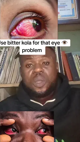 bitter kola #creatorsearchinsight #bitterkola #like #fyp #spirituality 