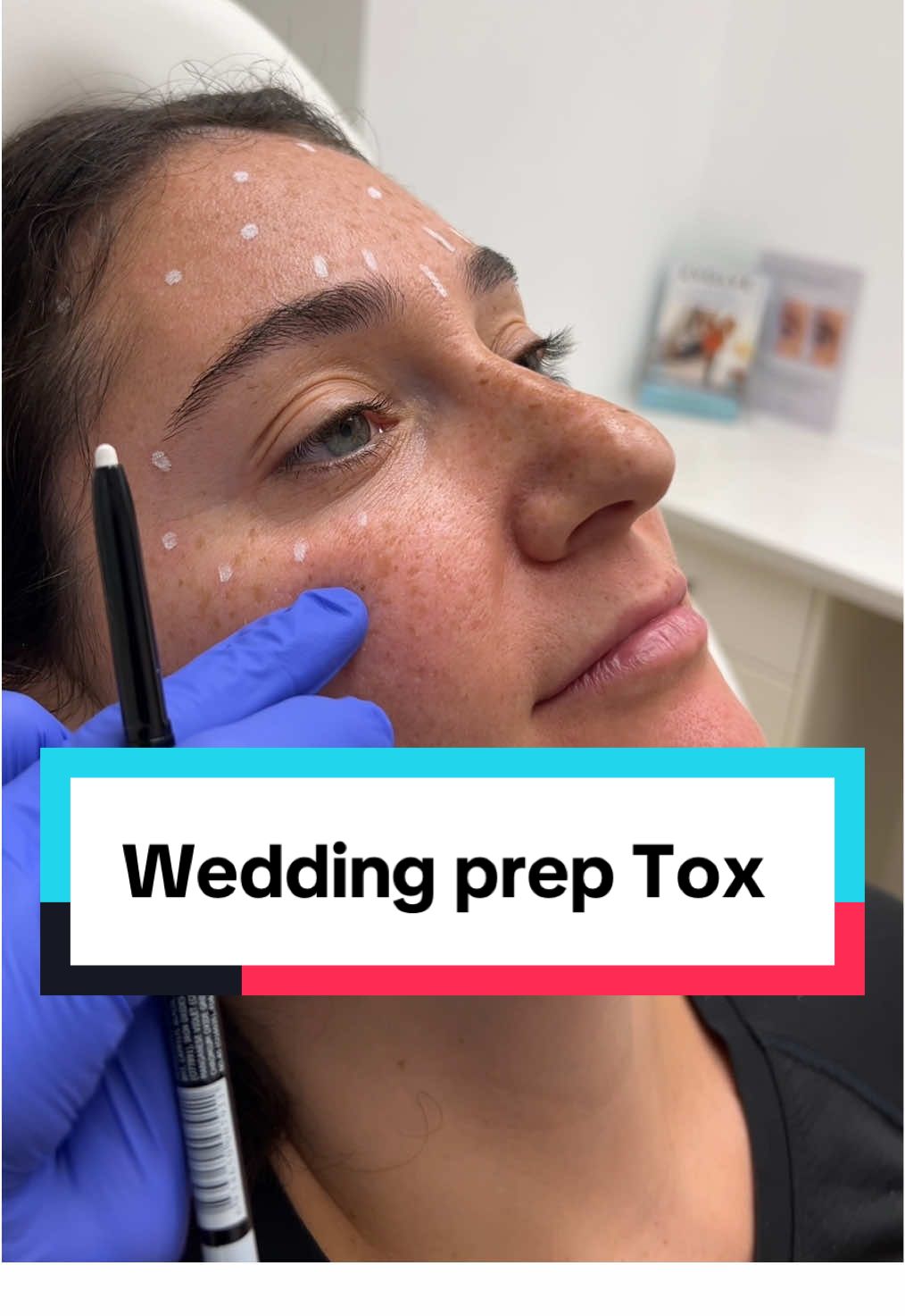 A beautiful Bride to be prepping her skin 9 months out from the big day 💍❤️😍 #educational #asmr #unintentionalasmr #calming #soothing #weddingprep #chicagobride #bridetobe #botoxbossbrides #skincare #weddingtok #weddingplanning #chicagoinjector #bridalbotox #relaxsss 