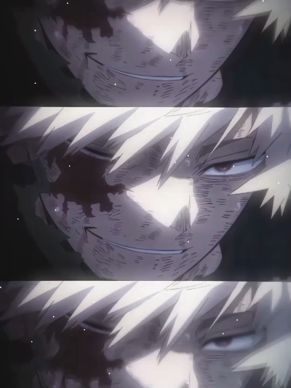 : Đầu bạc rồi mà để con nít nó chửi coi có quê hong=)) #bakugoukatsuki #kacchan 