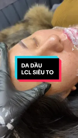 Trên nền da siêu dầu và lỗ chân lông thì Hạt sẽ ntn nha #pmu  #xuhuong 