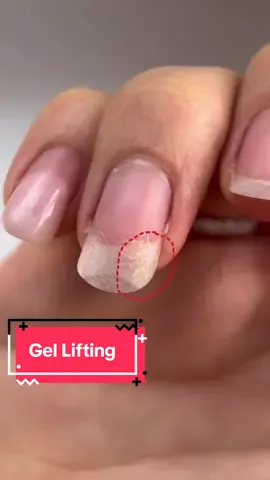 This is what happens when you overwear your gel #gelnails #gellifting #naildamage #nailtech #russianmanicure #nailrepair 