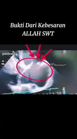 Bukti Dari Kebesaran ALLAH SWT 😇 #islamic #reminder #kebesaranallah #hijrah #delfaa2012 