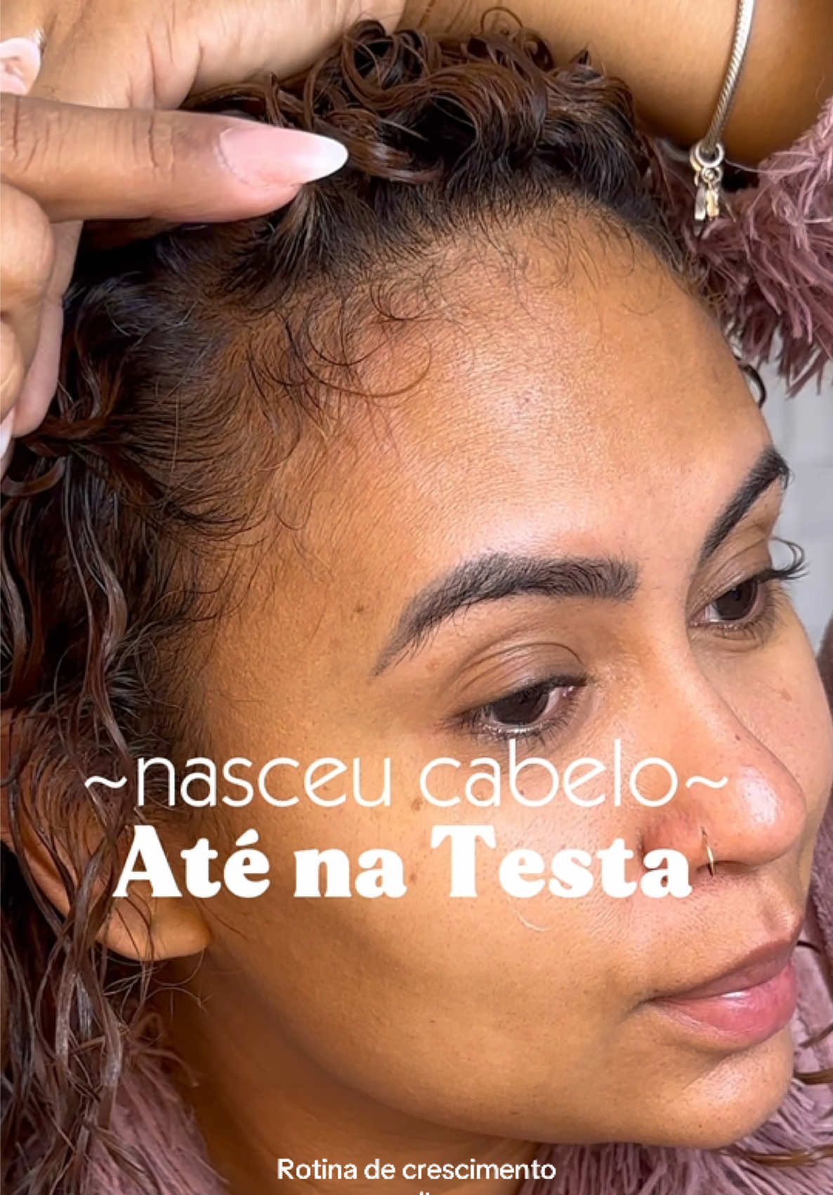 Nasceu cabelo até na testa?  Essas dicas fizeram meu cabelo parar de cair e crescer muito mais forte e saudável. 1° Usar tônico capilar todos os dias 2° Cuidar das postas, pois se a ponta quebra você não ver o cumprimento do cabelo. A linha pink fatal é lançamento da Salon Line, totalmente focada no crescimento saudável dos fios. - - #quedacapilar #crescimentocapilar #cachoslongos #projetorapuzel #cabelão 