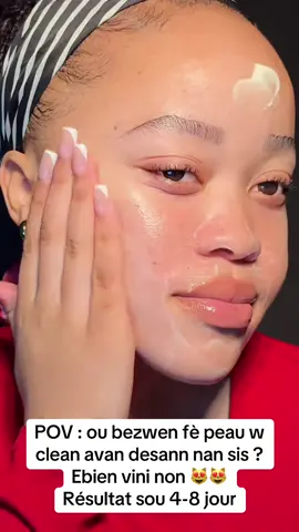 Pou plis info ekrim oswa kite yon komantè map reponn ou ✨🤍 #usa🇺🇸tiktok #haitiantiktok🇭🇹 #tiktokayisyen #haitiusa #darkspottreatment #skincarerecomendation #boutonhormonal #skincareproduct #hyperpigmentationtreatment #skincare #haitiantiktok 