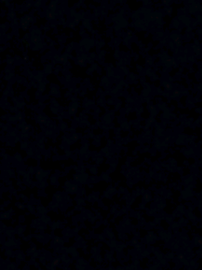 tkk só me flopa af 💔  . . . . #fyp #foryoupage #billieeilish #billieeilishedits #entaotoma 