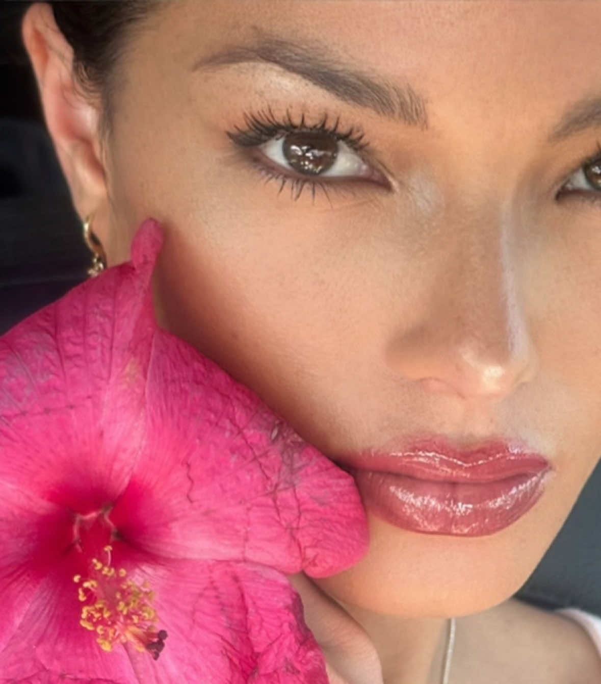 Day 2. Loopy. Losin it. I can’t sit still it’s so hard for me to “rest” #health #dental #work #fyp #hawaii 