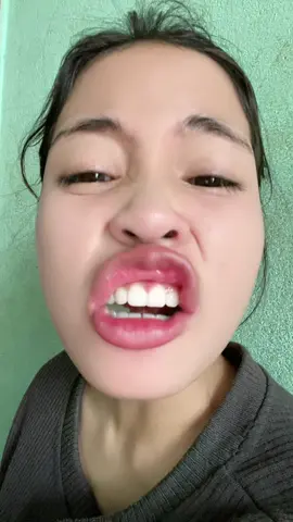 #xuhuongtiktok #xuhuongtiktok 