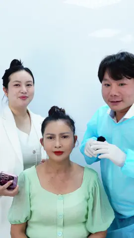 Trả kết quả cho chị một tháng căng da và cấy HA collagen#cangda #hacollagen #thammyvien 