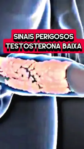 💥LINK NA BIO💥 #testosterona #viralvideos #brasil🇧🇷 #quiropraxia #altura 