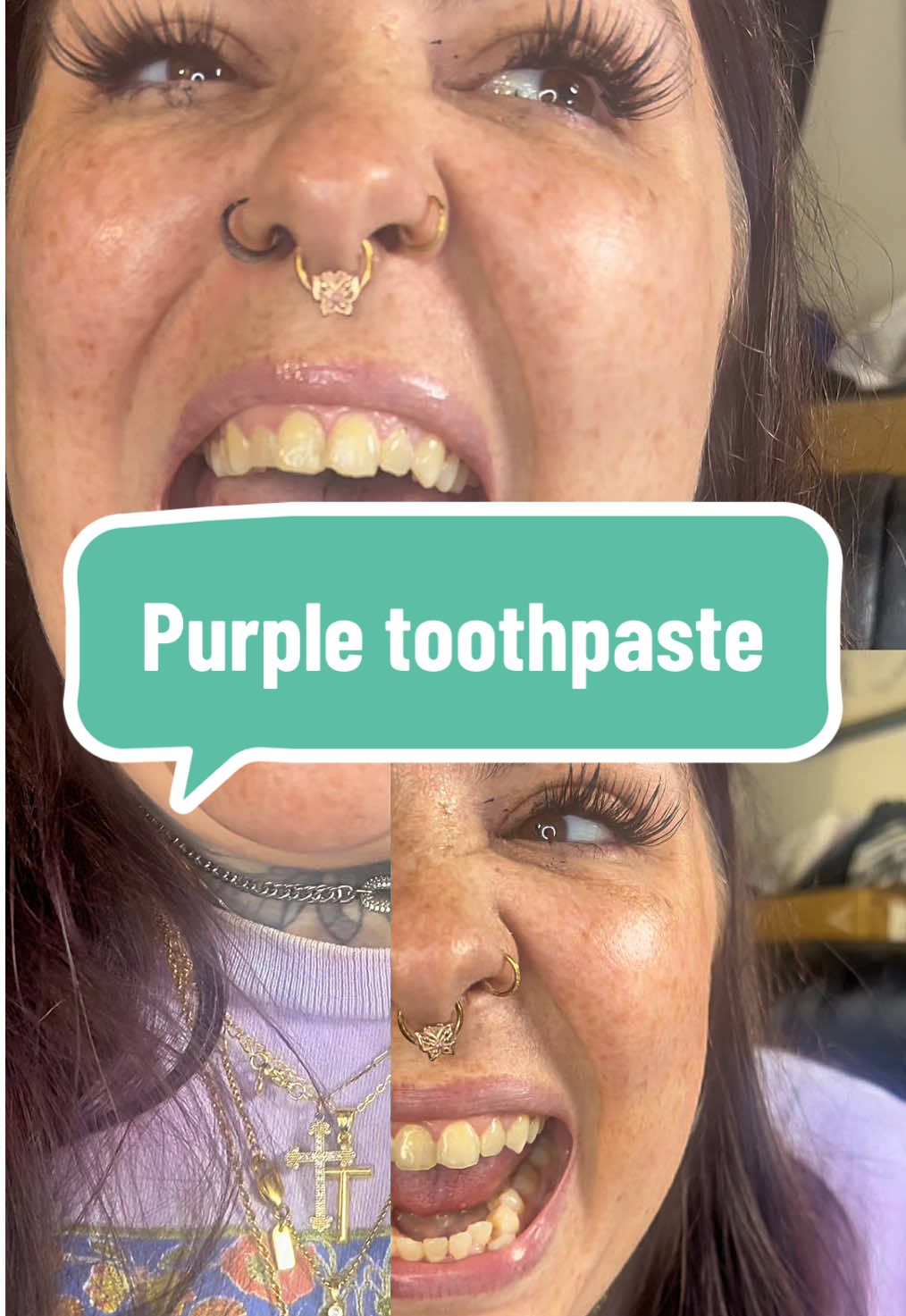 This PURPLE toothpaste erased my stains?! #teethwhitening #purpleshampoo #beautyhacks #productreview #smilemakeover 