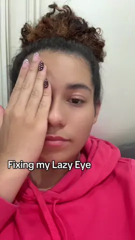 Fixing my lazy eye since it bothers you all so much 😢 #lazyeye #trend 