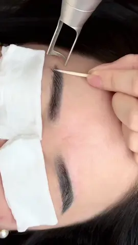 Cặp chân mày đen cộng thêm 10 tuổi đấy các chị ạ #xoaxamlaser #xoaxam #sonalyxoaxam #xoaxamlongmay #laser #sonaly #phunxamthammy 