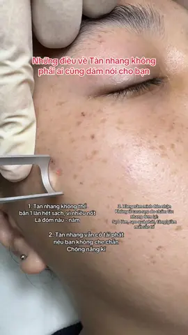 Các sự thật về tàn nhanh #miaclinic 
