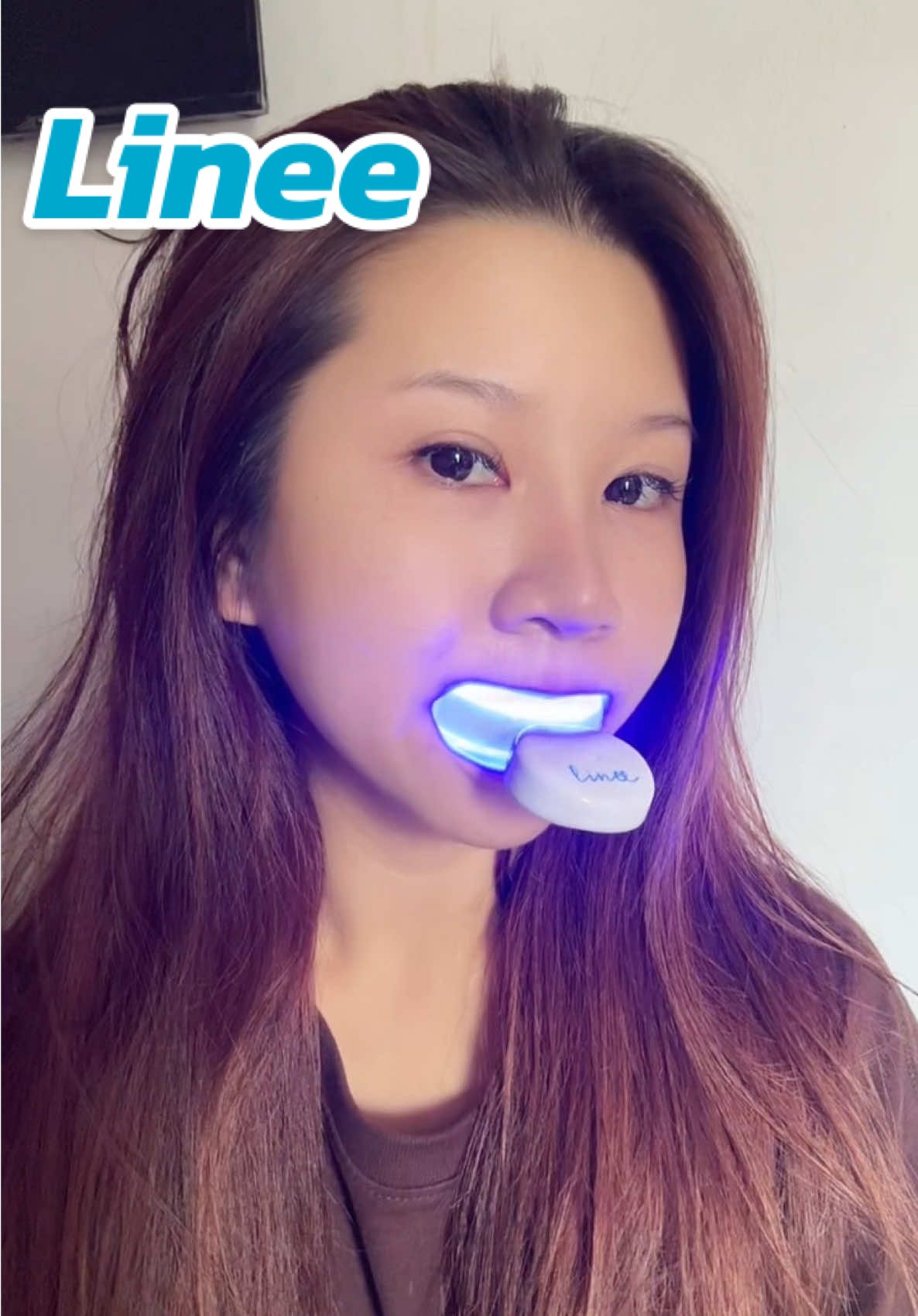 ฟอกสีฟันเองที่บ้านได้ง่ายๆ ใช้เวลาแค่ 15-20 นาที 🦷  #lineeteeth #เครื่องฟอกสีฟันลินี #อุปกรณ์ฟอกฟันขาวลินี #ลินีรีวิว #ฟอกฟันขาว