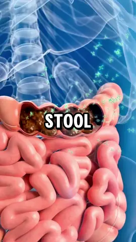 This One Natural Remedy Heals Both Constipation and Diarrhea! 😮 #health #naturalremedies #guthealth #constipation #diarrhea 