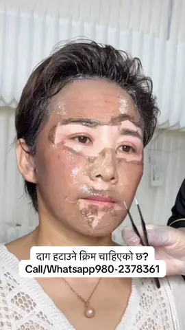 #musergeneretion #foryoupage #viralvideo #tiktok #scar 