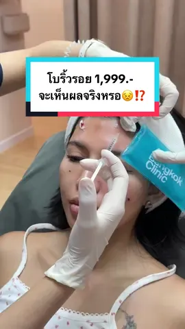 โบริ้วรอย 1,999.- จะเห็นผลจริงหรอ😣⁉️ #auraxpress #botox #โบริ้วรอย #ริ้วรอยบนใบหน้า #หัตถการ 