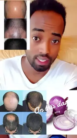 #onthisday