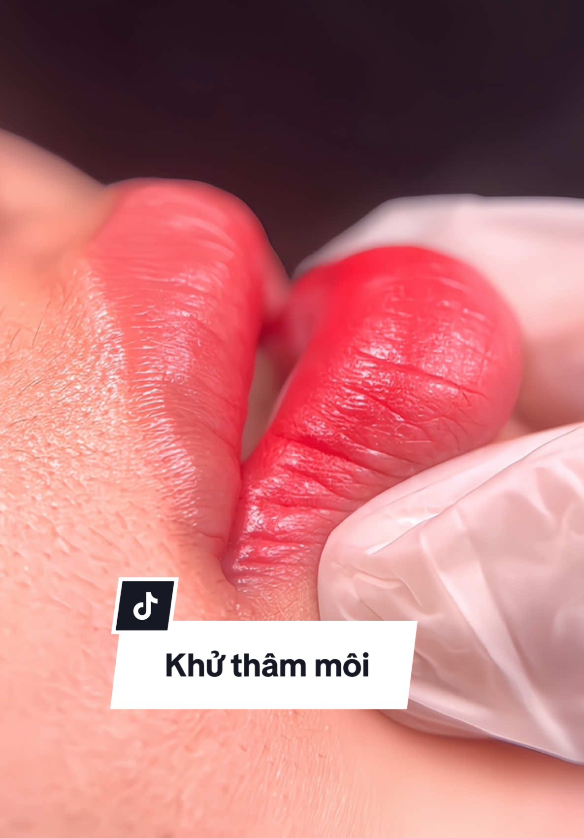 Tạm biệt môi thâm – chào đón đôi môi hồng tự nhiên 🌷 Nhanh tay đặt lịch khử thâm môi trong chương trình ‘Làm đẹp kịp Tết cùng Jolie” #khuthammoi #phunxamtunhien #phunxamthammy #lamdep #binhduong 