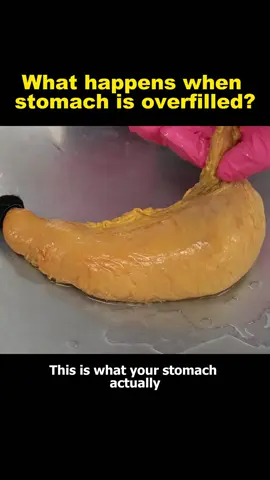 What happens when your stomach is overfilled?#stomach #knowledge #tiktok #fyp 