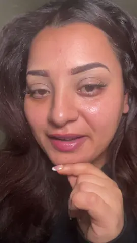 Just a appreciation post for my skincare and how far my skins come ❤️🥺 #fyp #skincare #skincarejourney #skincaregoals 