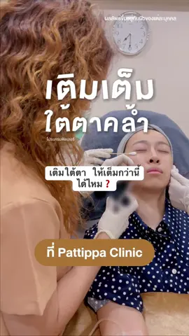เติมให้เต็มกว่านี้ได้ แต่ไม่ทำ❌ #pattippaฉีดหน้าไม่โป๊ะ Program #Filler Program #ฟิลเลอร์ใต้ตา #ลดฝ้ากระจุดด่างดํา #ใต้ตาคล้ํา  @หมอเต้หมอเธีย เคลียร์เรื่องผิว  @หมอเต้หมอเธีย เคลียร์เรื่องผิว  @หมอเต้หมอเธีย เคลียร์เรื่องผิว 