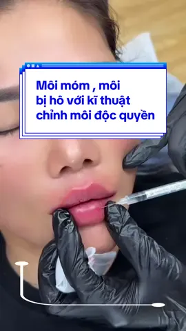 CHỈNH MÔI MÓM, môi dưới cụp vào trog, cho dáng môi xinh hơn#fillerbotox #fullface #botox #tiemmoi @HỌC VIỆN CHIANG MIE @VIỆN THẨM MỸ CHIANG MIE 
