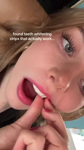 GET THEM WHILE THEYRE SO CHEAP!!! #teethwhitening #tiktokshop 