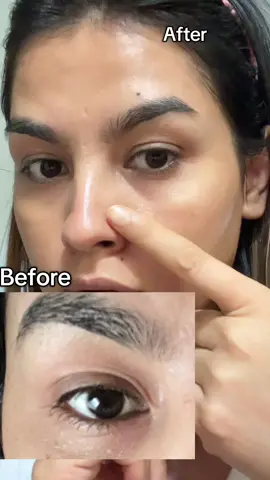 Eyebag and Dark Circles? I got you #draltheabloomers #dralthea #Retinol #dralthearetinol #fyp @Dr.Althea US 