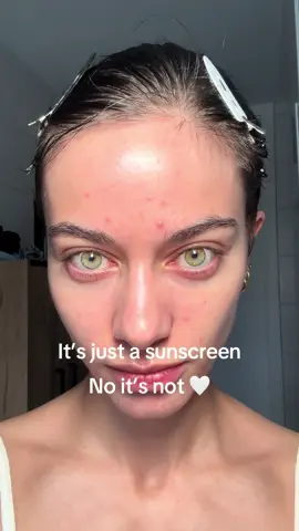 it only took me 4 breakouts and 3 mental breakdowns to find the right one ☀️💅#sunscreen #acne #perfectfit #skincare 