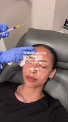 Skin brightening that you’ll never be able to say no to again #prp 