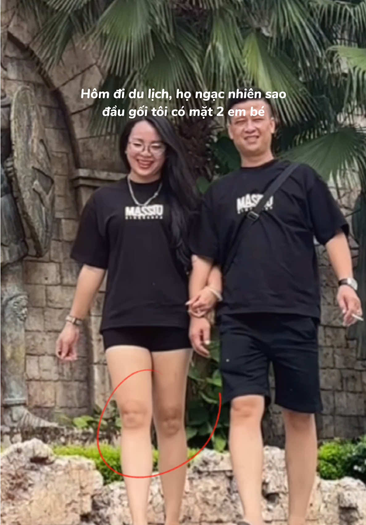 Câu chuyện hôm đi du lịch bây giờ mới kể, vẫn nhiều người ngạc nhiên và thu hút bởi đầu gối của tui lắm 😂