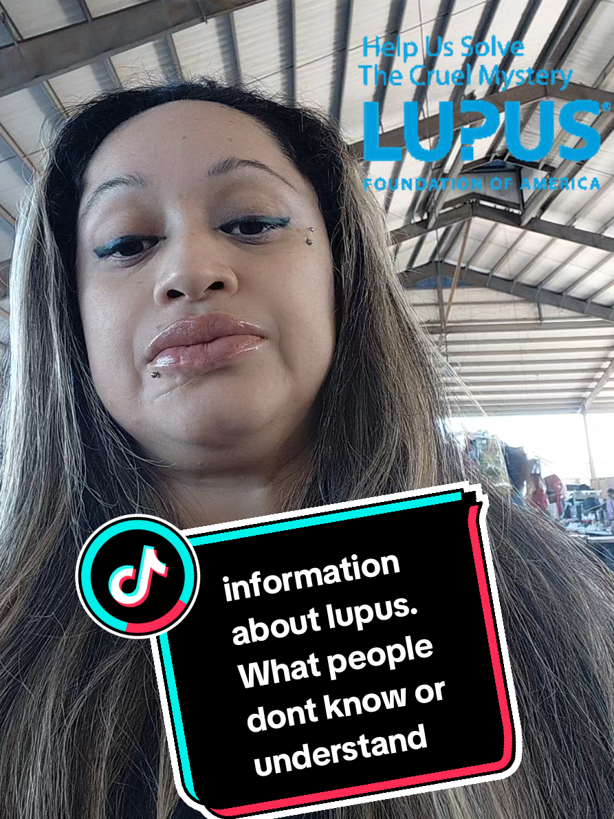Information about lupus.  What people don't know or understand. #information #lupus #lupuswarrior #awareness #viral 