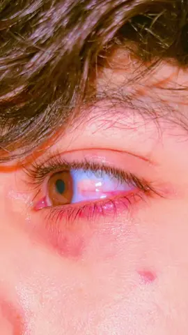 🫵🏻Za Pata zaghamala nasham🙃.  🫴🏻🫀S🥹@នʜ≛⃝❤️࿐♥Ɫ𝗼𝓿𝐞𝑟♥ 