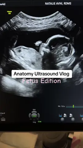 but imagine how tired we are…. 😂 #ultrasoundtech #fetus #anatomyscan #pregnancy #pregnancyhumor 