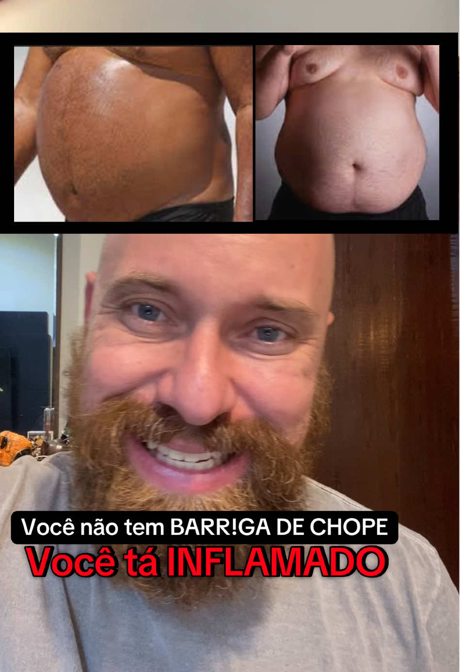 Se você tá assim… você precisa assistir esse vídeo!  O óleo de semente de abóbora pode te ajudar!  #oleodesementedeabobora #oleodeabobora #sementedeabobora #homens #saudedohomem 