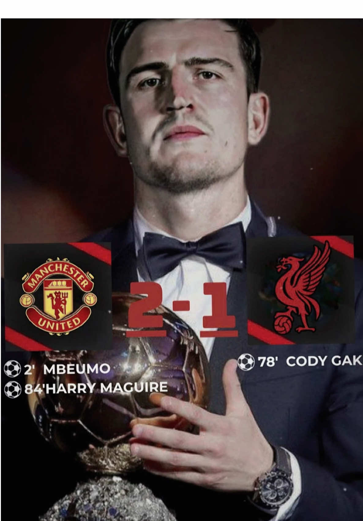 Liverpool hãy cảm nhận nỗi đau , nhà báo đã nói gì nào 🗣️🔥🔥#CapCut #bongda #football #manchesterunited #liverpool 