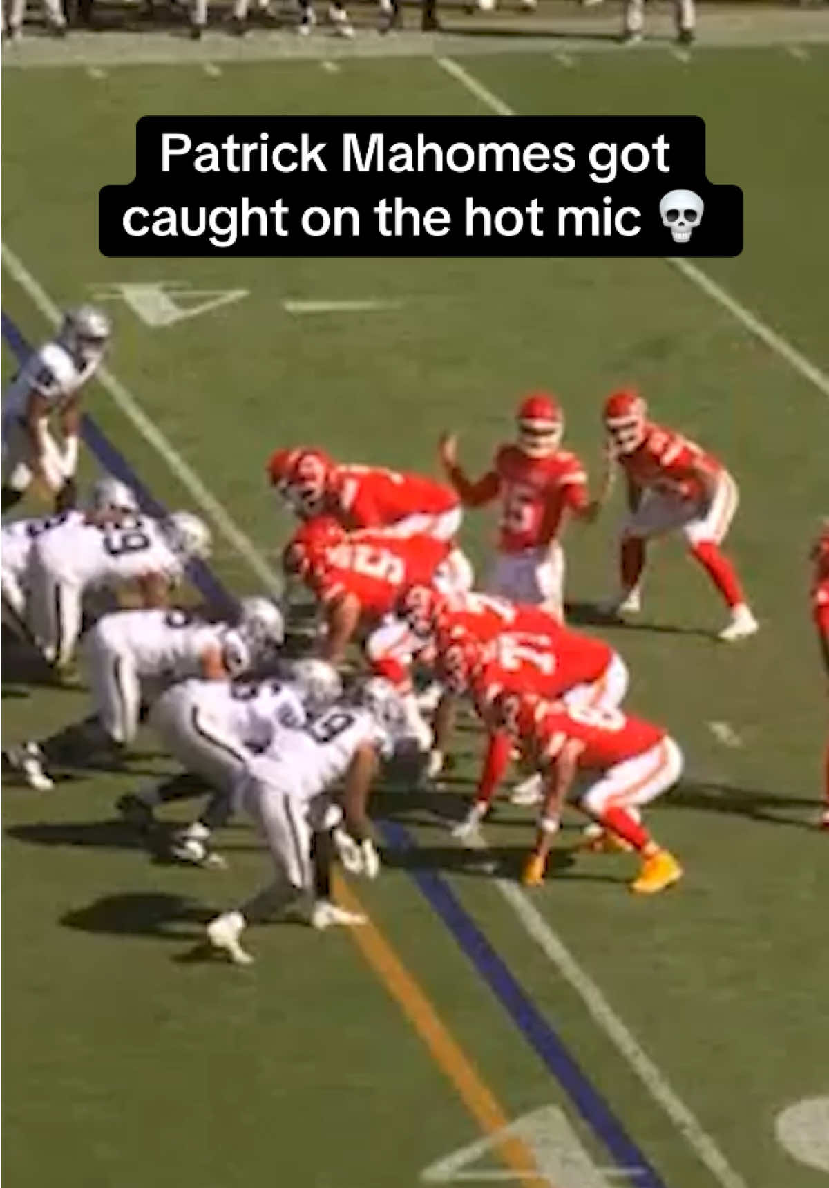 Oopsie 😂😂 #nfl #chiefs #patrickmahomes (🎥: CBS) 