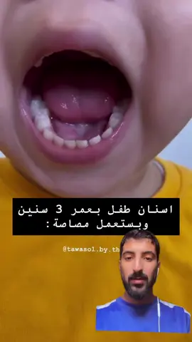 اثارع مشكله ف انتبهو الله يحفظ الجميع@المستر سلطان المضحي📚📊 