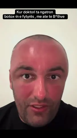 #samed #botox #samedfeka #doktor  Kush esht i interesuar  te me kontaktoj se e kam mik doktorin? 