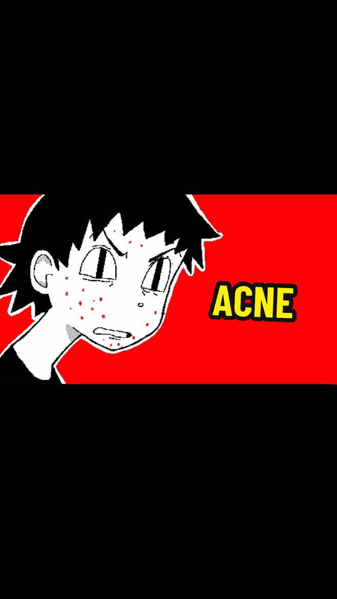 The worst thing EVER, acne #storytime #animation #xyzabc #viral #fyp 