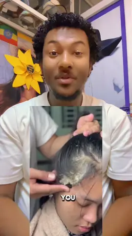 Home made anti dandruff #jspbeautyandfation2 #jspbeautyandfation #jspluxurybeautystore @Jsp Beauty Ethiopia 🇪🇹 