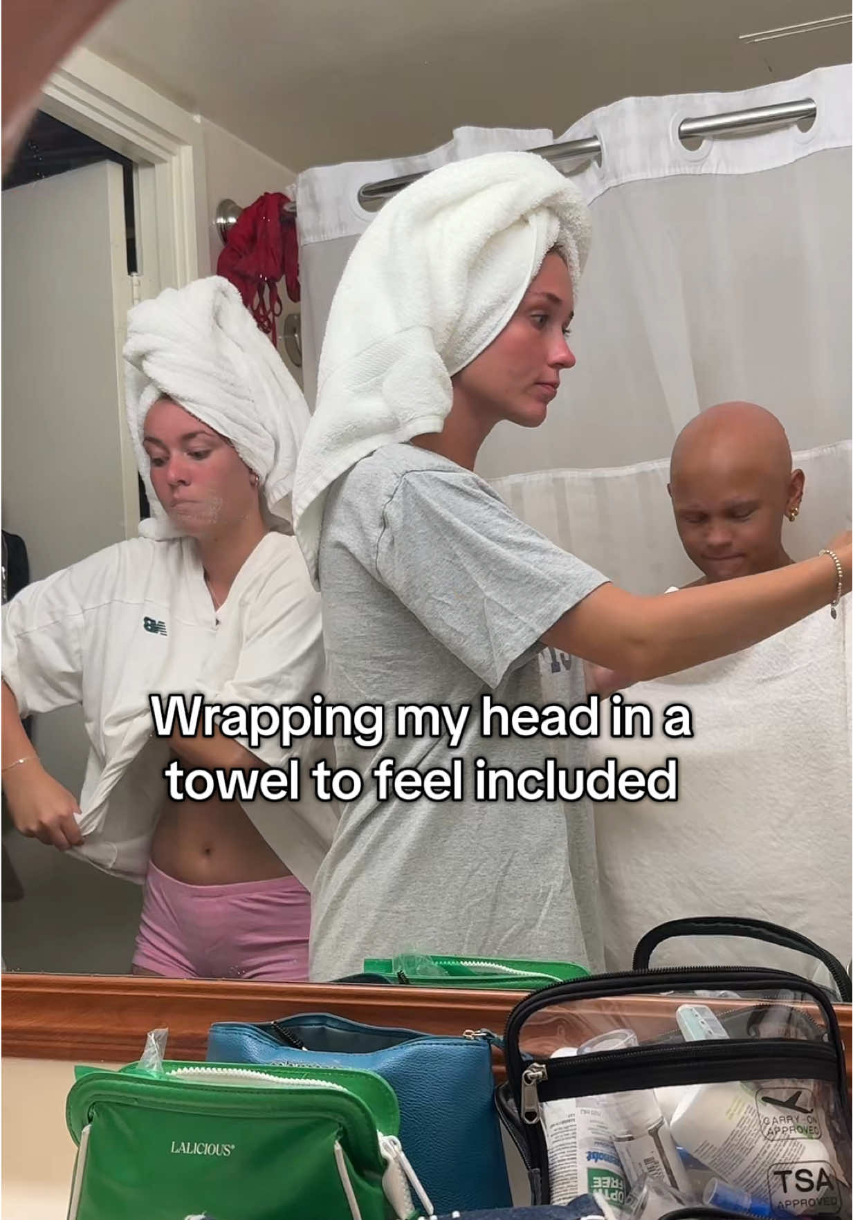 Wish I had hair 😔 #lol #fyp #alopecia #friends #vacation