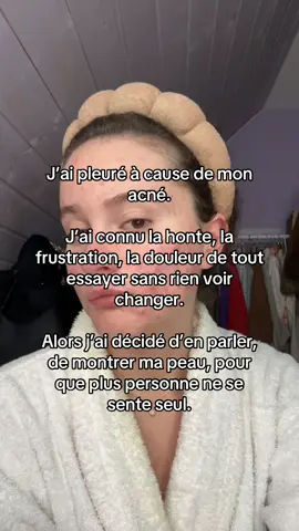 Je ne jugerai jamais les choix d’une personne qui essaie de s’en sortir. Roaccutane, pilule, traitements naturels, alimentation, plantes, crèmes… chacun fait ce qu’il peut pour aller mieux. Je sais à quel point c’est dur de se regarder dans le miroir, de se sentir incompris, d’entendre “ce n’est que de l’acné” alors que ça détruit peu à peu la confiance qu’on avait en soi. Je ne suis pas là pour dire qu’il existe une solution miracle, ni pour critiquer les choix des autres. Je suis là pour partager mon expérience, pour montrer que oui, on peut traverser cette épreuve, mais surtout pour rappeler que personne ne mérite de se sentir honteux à cause de sa peau. L’acné, c’est bien plus que des boutons. C’est un combat contre soi-même, contre le regard des autres, contre la fatigue d’essayer sans résultat. Et si mes vidéos peuvent aider ne serait-ce qu’une seule personne à se sentir un peu moins seule, alors tout ça en vaut la peine. #acné #acnehormonal #acneproneskin #sopk #acne 