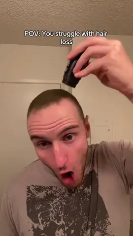 Hair loss brutal 🥀 #hair #hairtransformation #hairgrowth #joke #bald 